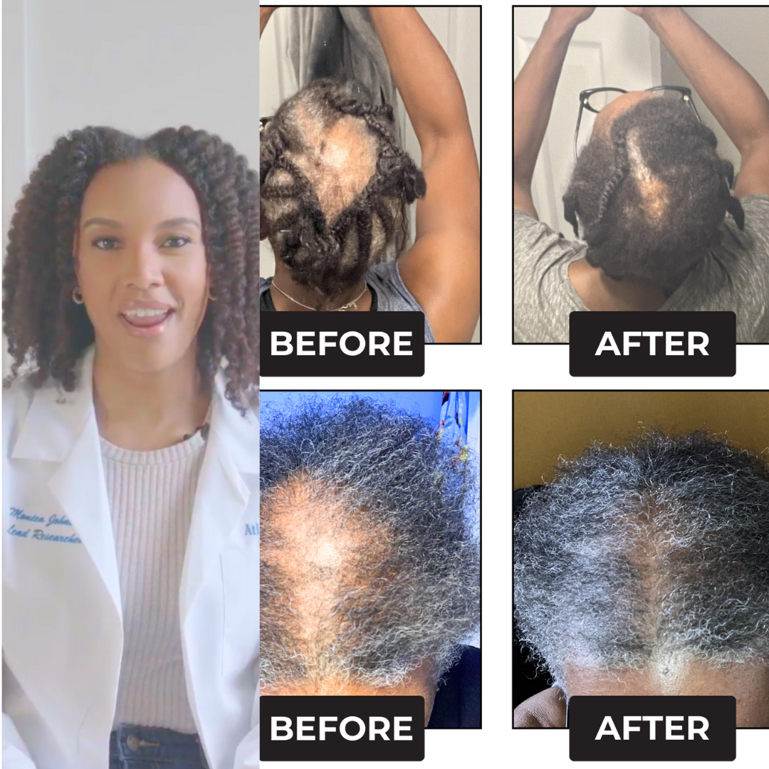 Rennora Hair Growth Serum