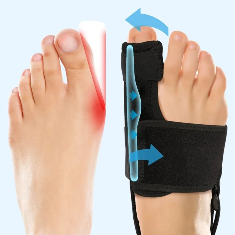 StopValgus™ - Correcteur d’Hallux Valgus