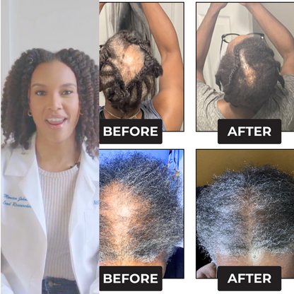 Rennora Hair Growth Serum