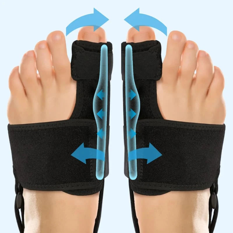 StopValgus™ - Correcteur d’Hallux Valgus